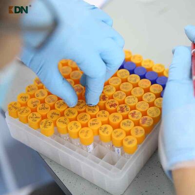 İyi bir fiyat. Yağ lekesi temizleme ajanı Enzimi kaldırın Ağır görev temizleme uygulamaları için optimize edilmiş peptidler ve amino asitler kullanır çevrimiçi